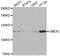 Ubiquitin Protein Ligase E3C antibody, STJ28525, St John