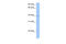 ZFP92 Zinc Finger Protein antibody, 30-688, ProSci, Enzyme Linked Immunosorbent Assay image 