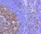 Cyclin Dependent Kinase 1 antibody, GTX01143, GeneTex, Immunohistochemistry paraffin image 