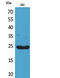 Lymphotactin antibody, A04548-1, Boster Biological Technology, Western Blot image 