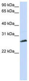 Synaptonemal Complex Protein 3 antibody, TA344376, Origene, Western Blot image 