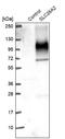 Solute Carrier Family 26 Member 2 antibody, NBP2-49271, Novus Biologicals, Western Blot image 