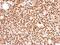 Forkhead Box O3 antibody, PA5-27145, Invitrogen Antibodies, Immunohistochemistry paraffin image 