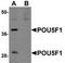 POU Class 5 Homeobox 1 antibody, TA306913, Origene, Western Blot image 