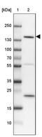 SLIT-ROBO Rho GTPase Activating Protein 3 antibody, PA5-57890, Invitrogen Antibodies, Western Blot image 