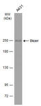 Dicer 1, Ribonuclease III antibody, GTX633917, GeneTex, Western Blot image 