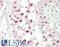 Nucleolin antibody, LS-B13562, Lifespan Biosciences, Immunohistochemistry paraffin image 