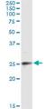 Ephrin A3 antibody, H00001944-M10, Novus Biologicals, Immunoprecipitation image 