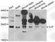 Interleukin-1 family member 7 antibody, A8206, ABclonal Technology, Western Blot image 
