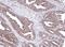 Propionyl-CoA Carboxylase Subunit Beta antibody, PA5-21647, Invitrogen Antibodies, Immunohistochemistry paraffin image 