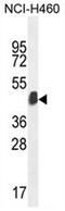 Keratin 80 antibody, AP52423PU-N, Origene, Western Blot image 