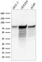 Minichromosome Maintenance Complex Component 7 antibody, GTX34817, GeneTex, Western Blot image 