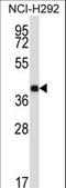 Synaptotagmin 2 antibody, LS-C161653, Lifespan Biosciences, Western Blot image 