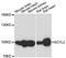 SCY1 Like Pseudokinase 2 antibody, A13178, ABclonal Technology, Western Blot image 