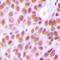 Nuclear Autoantigenic Sperm Protein antibody, abx225305, Abbexa, Western Blot image 