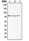 Solute Carrier Family 6 Member 15 antibody, orb215208, Biorbyt, Western Blot image 