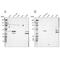 Sarcolemma Associated Protein antibody, NBP1-81397, Novus Biologicals, Western Blot image 