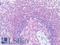 CD33 Molecule antibody, LS-A12000, Lifespan Biosciences, Immunohistochemistry paraffin image 