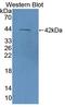 CD3d Molecule antibody, LS-C374257, Lifespan Biosciences, Western Blot image 