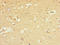 Gamma-Aminobutyric Acid Type A Receptor Alpha5 Subunit antibody, LS-C675786, Lifespan Biosciences, Immunohistochemistry paraffin image 