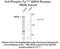 Glutamate Ionotropic Receptor NMDA Type Subunit 2B antibody, NB300-292, Novus Biologicals, Western Blot image 