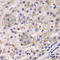 Eukaryotic Translation Elongation Factor 2 antibody, A2068, ABclonal Technology, Immunohistochemistry paraffin image 