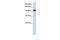 Splicing Factor SWAP antibody, GTX47368, GeneTex, Western Blot image 