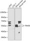 TNF Receptor Associated Factor 6 antibody, GTX32932, GeneTex, Western Blot image 