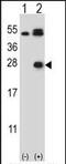 Kallikrein Related Peptidase 6 antibody, PA5-35313, Invitrogen Antibodies, Western Blot image 