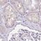 Cyclase Associated Actin Cytoskeleton Regulatory Protein 2 antibody, NBP2-30561, Novus Biologicals, Immunohistochemistry paraffin image 