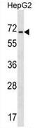 Amiloride-sensitive cation channel 4 antibody, AP50045PU-N, Origene, Western Blot image 