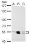 LYN Proto-Oncogene, Src Family Tyrosine Kinase antibody, PA5-27361, Invitrogen Antibodies, Western Blot image 