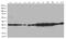 Lactamase Beta 2 antibody, M11709, Boster Biological Technology, Western Blot image 