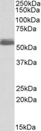 Adrenoceptor Beta 1 antibody, LS-C54455, Lifespan Biosciences, Western Blot image 