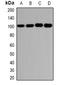 Glutamate Ionotropic Receptor AMPA Type Subunit 3 antibody, orb378087, Biorbyt, Western Blot image 