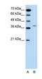 Receptor Associated Protein Of The Synapse antibody, orb325051, Biorbyt, Western Blot image 