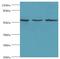 Myotilin antibody, MBS1493502, MyBioSource, Western Blot image 