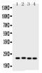 Suppressor Of Cytokine Signaling 2 antibody, LS-C357584, Lifespan Biosciences, Western Blot image 