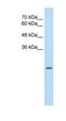 Aldehyde Dehydrogenase 4 Family Member A1 antibody, NBP1-54739, Novus Biologicals, Western Blot image 