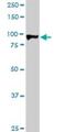 HIC ZBTB Transcriptional Repressor 1 antibody, H00003090-M02, Novus Biologicals, Western Blot image 