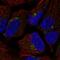 Transmembrane Protein 80 antibody, HPA059592, Atlas Antibodies, Immunofluorescence image 