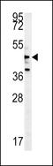 Nemo Like Kinase antibody, MBS9213408, MyBioSource, Western Blot image 