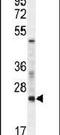 RAN, Member RAS Oncogene Family antibody, PA5-25902, Invitrogen Antibodies, Western Blot image 