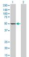 Zwilch Kinetochore Protein antibody, H00055055-M01, Novus Biologicals, Western Blot image 