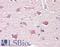 Inositol-Tetrakisphosphate 1-Kinase antibody, LS-B9944, Lifespan Biosciences, Immunohistochemistry paraffin image 