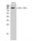 Protein Tyrosine Kinase 2 Beta antibody, LS-C381213, Lifespan Biosciences, Western Blot image 