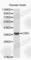 Corticotropin Releasing Hormone antibody, A1122, ABclonal Technology, Western Blot image 