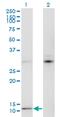 Mature T Cell Proliferation 1 antibody, MA5-19372, Invitrogen Antibodies, Western Blot image 