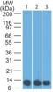 S100 Calcium Binding Protein A8 antibody, NBP2-25273, Novus Biologicals, Western Blot image 