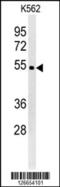 WD Repeat Domain 73 antibody, 61-875, ProSci, Western Blot image 